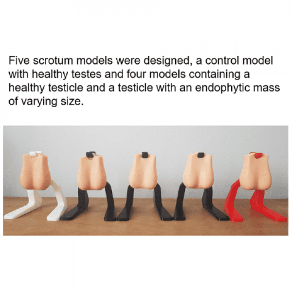 Image of five 3D printed testicular models. Text says: Five scrotum models were designed, a control model with healthy testes and four models containing a healthy testicle and a testicle with an endophytic mass of varying size.